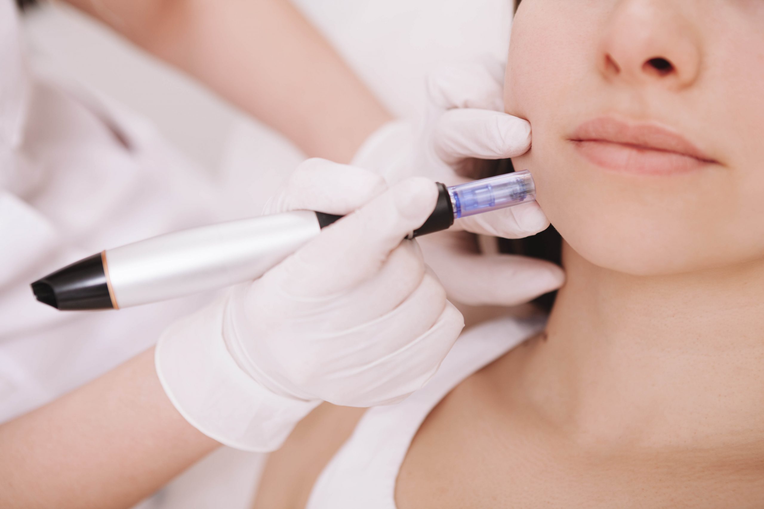 Cropped,Close,Up,Of,Unrecognizable,Woman,Getting,Mesotherapy,Procedure,At